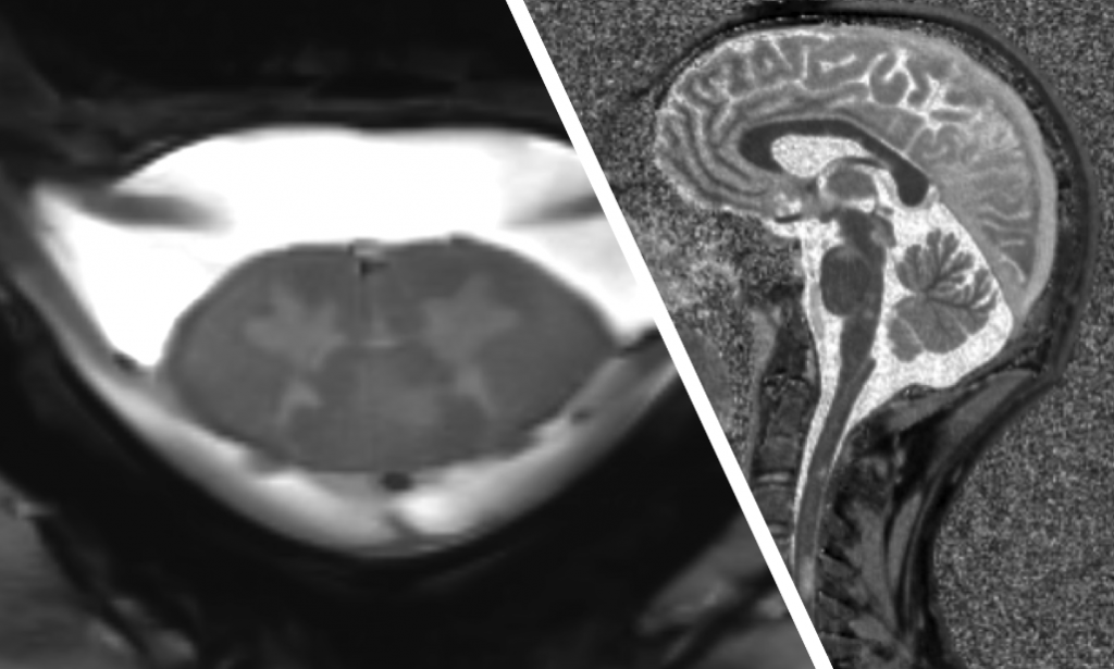 Central Nervous System - Center for Magnetic Resonance in Biology and ...